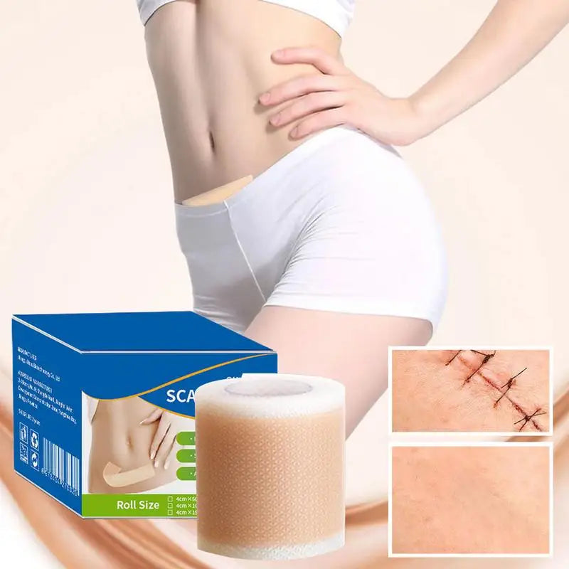 Silicone Scar Tape - All Fresh Finds