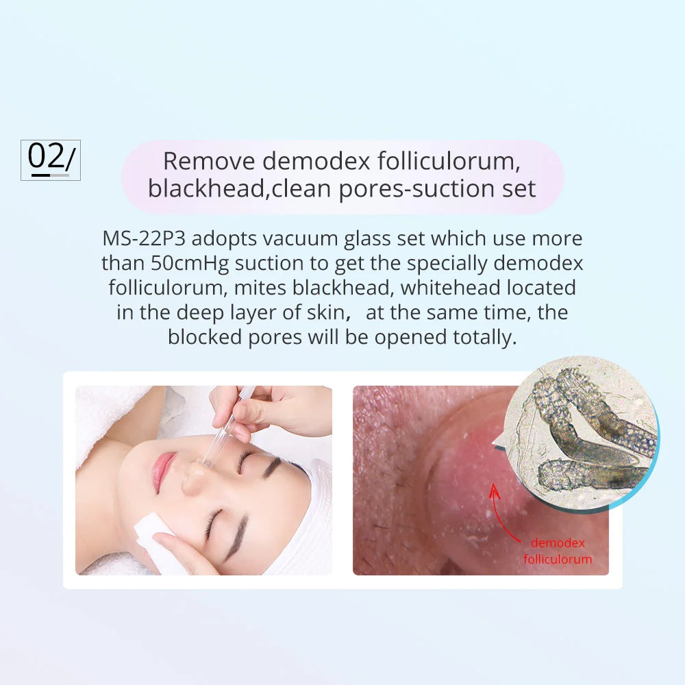 Microdermabrasion Dermabrasion Machine - All Fresh Finds
